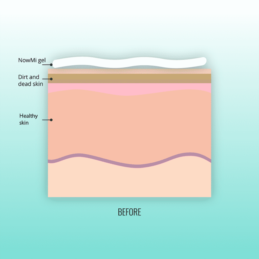Illustration of skin before NowMi exfoliation - NOWMI