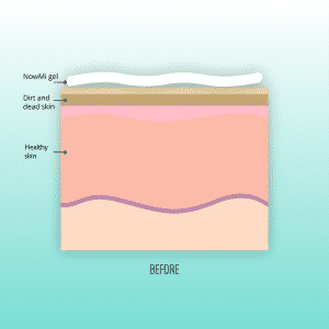 Illustration of the skin's layers before exfoliation with the NowMi device