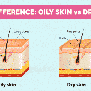 Oily skin vs. Dry skin