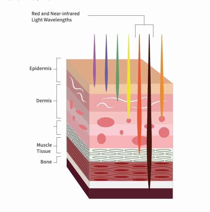 Illustration of NIR theray penetrating deep into the subcutaneous and muscle layers of the skin