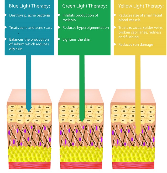 Diagram of 3 lights emitted during Low-level light therapy, blue light therapy for oily skin and acne, green light therapy for hyperpigmentation, and yellow light therapy for rosacea and sun damage